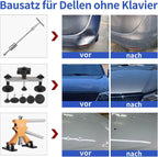 Auto Paintless Body Dent Removal Kits