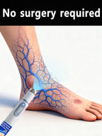 Laser Pointer For Improving Blood Circulation