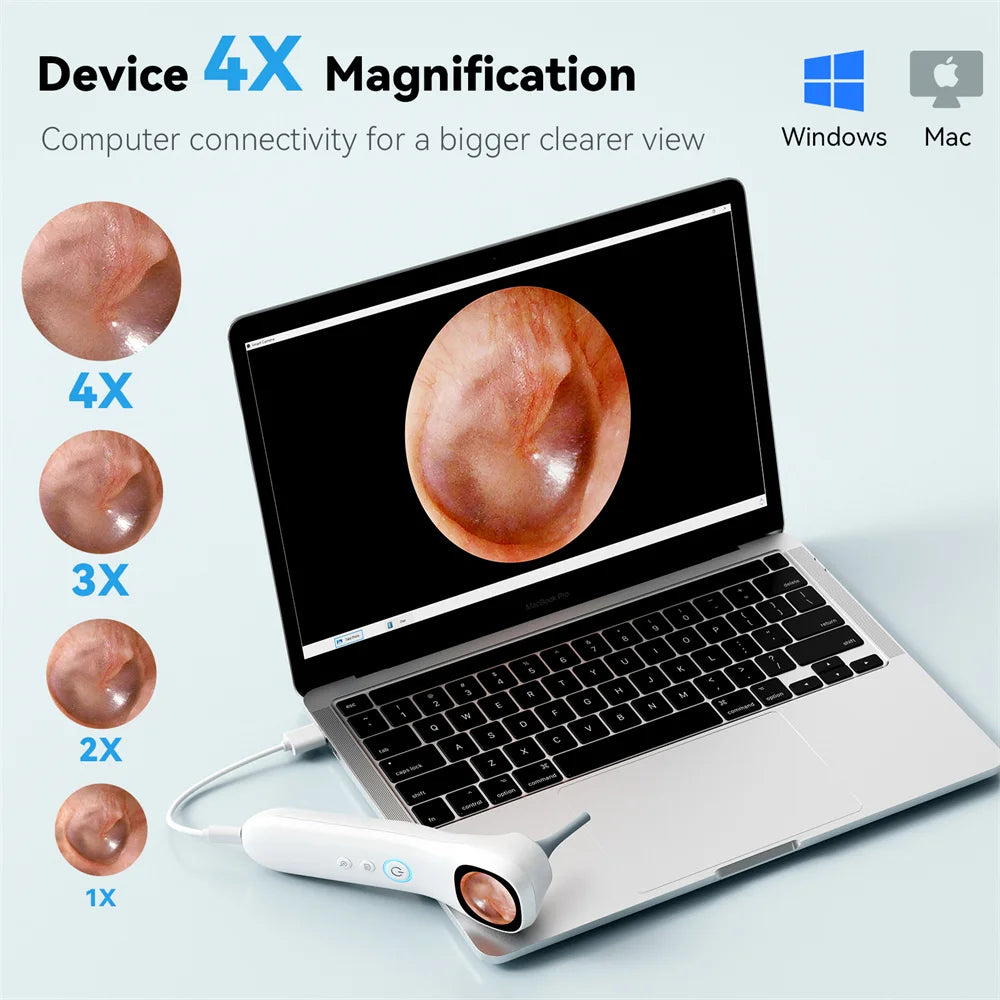 5-in-1 Ear Camera