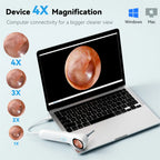 5-in-1 Ear Camera