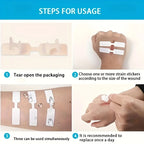 80 Butterfly-Shaped Wound Closure Strips