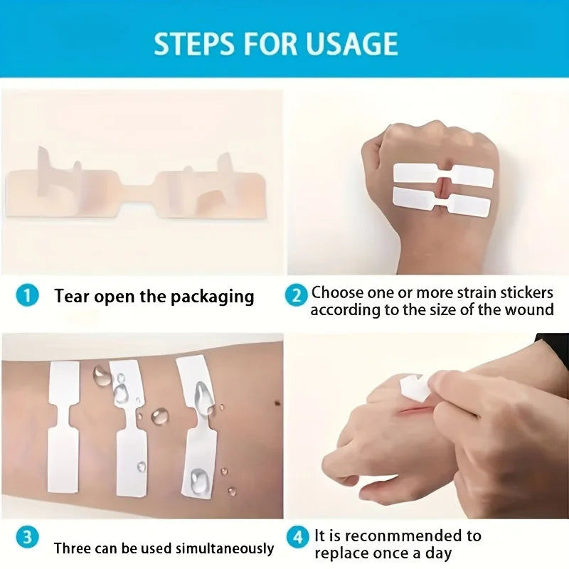 80 Butterfly-Shaped Wound Closure Strips